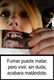 SEGUNDO PREMIO